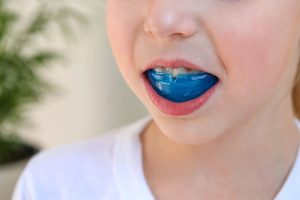 kids custom-fit mouthguard