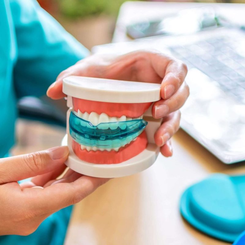 custom-fit mouthguard