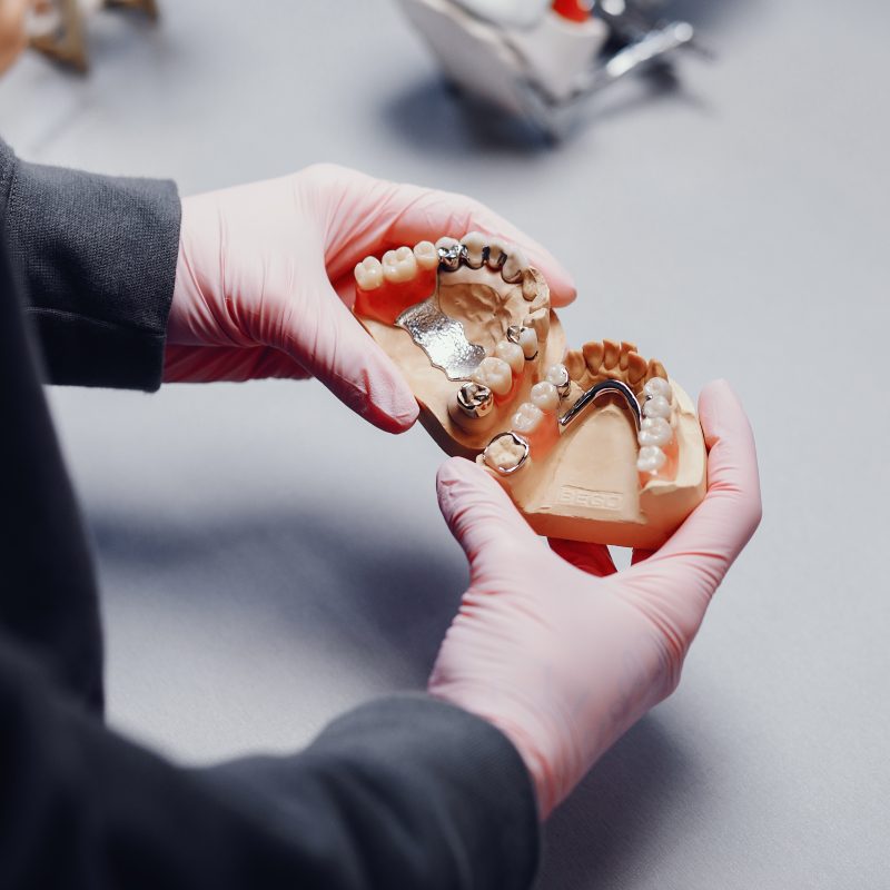 Denture Additions Ipswich