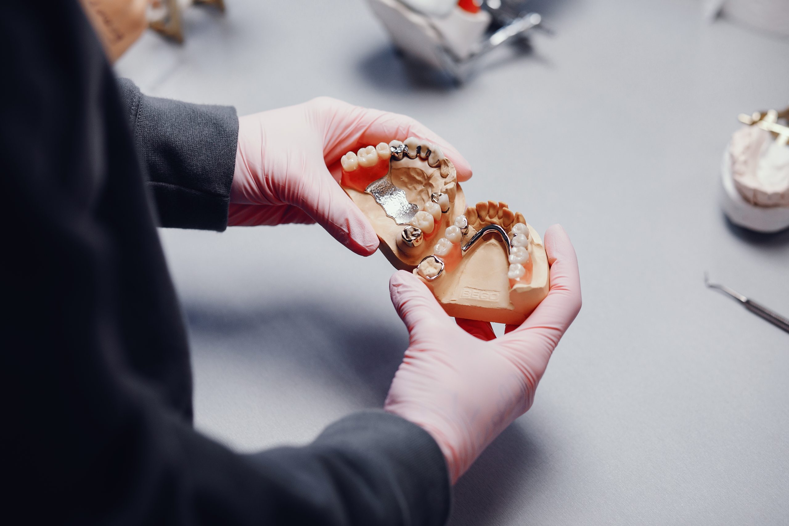 Denture Additions Ipswich: Best Options for Fast Repairs