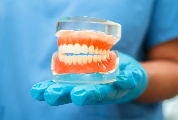custom dentures