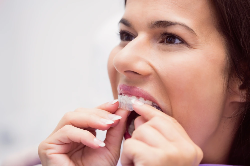 What to Expect When Getting a Sleep Guard for Teeth in Ipswich