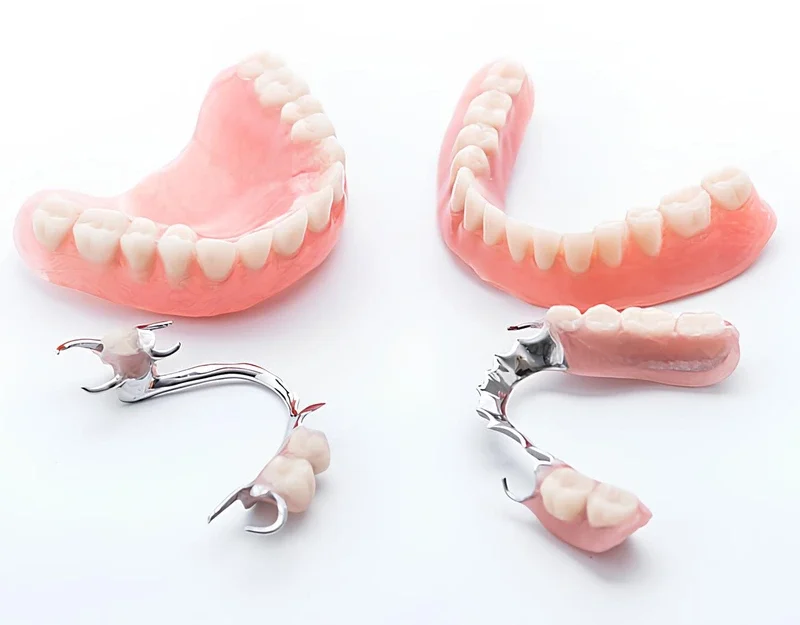 Acrylic and chrome dentures