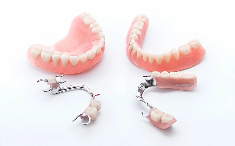 How to Decide Between Acrylic and Chrome Dentures in Ipswich